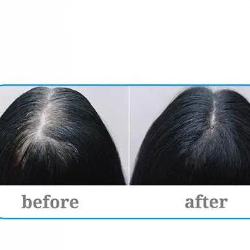 Roll-On Rosemary Hair Growth Elixir™